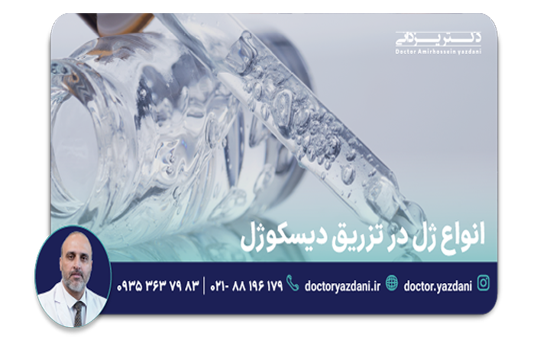 انواع ژل در تزریق دیسکوژل